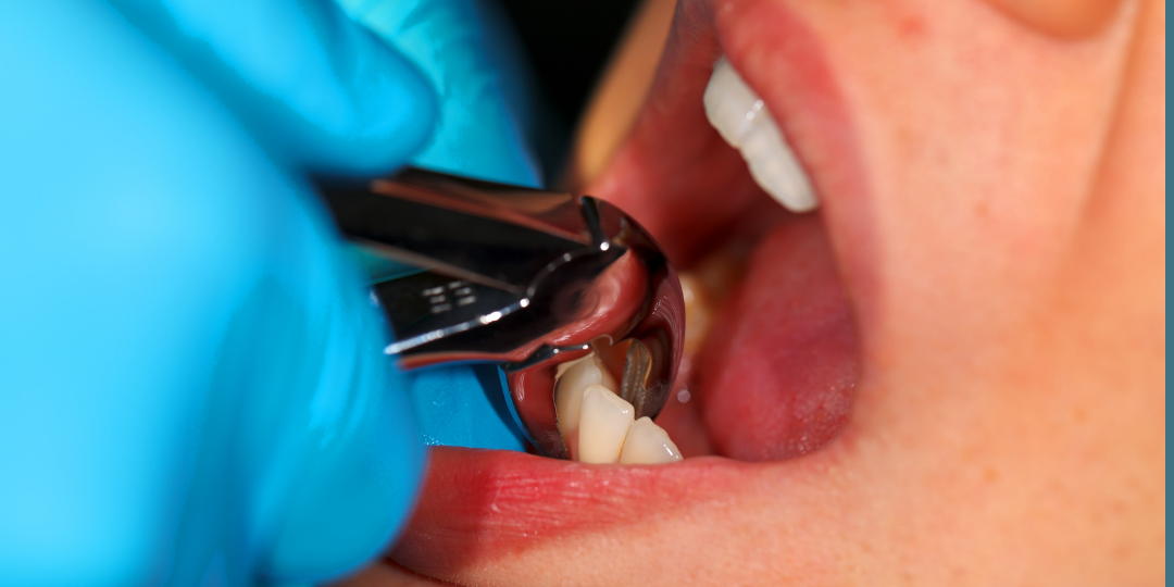 SABOR A SANGRE EN BOCA (1)