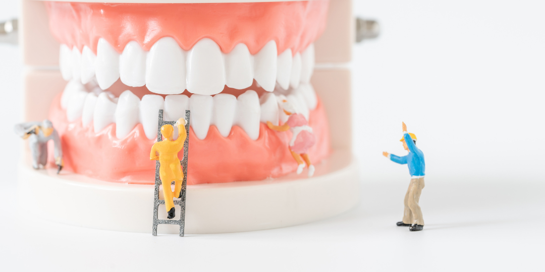 Injerto de encía cuándo lo necesitas y en qué consiste (28)