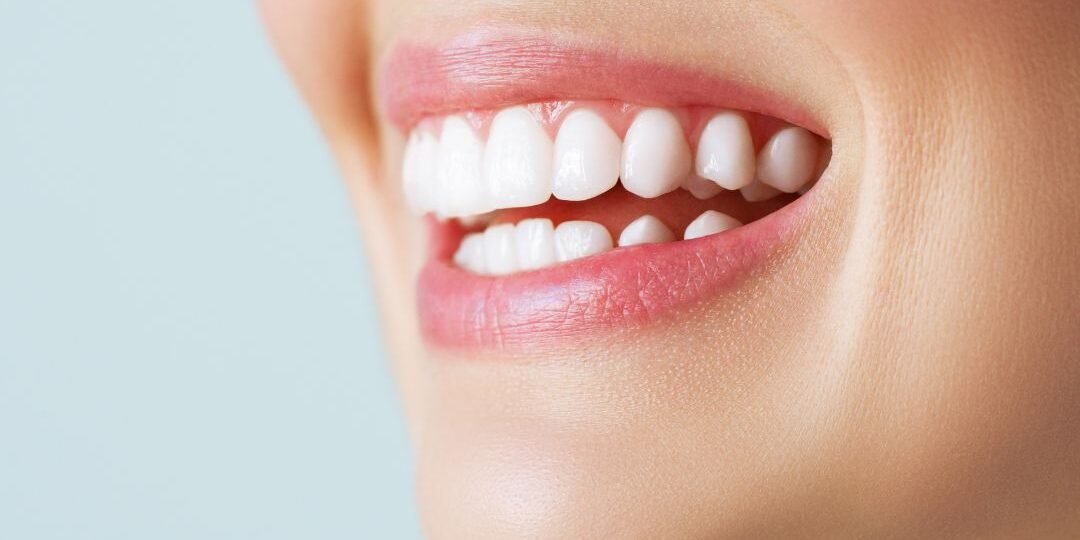 incisivos bilbao incisivos bilbao