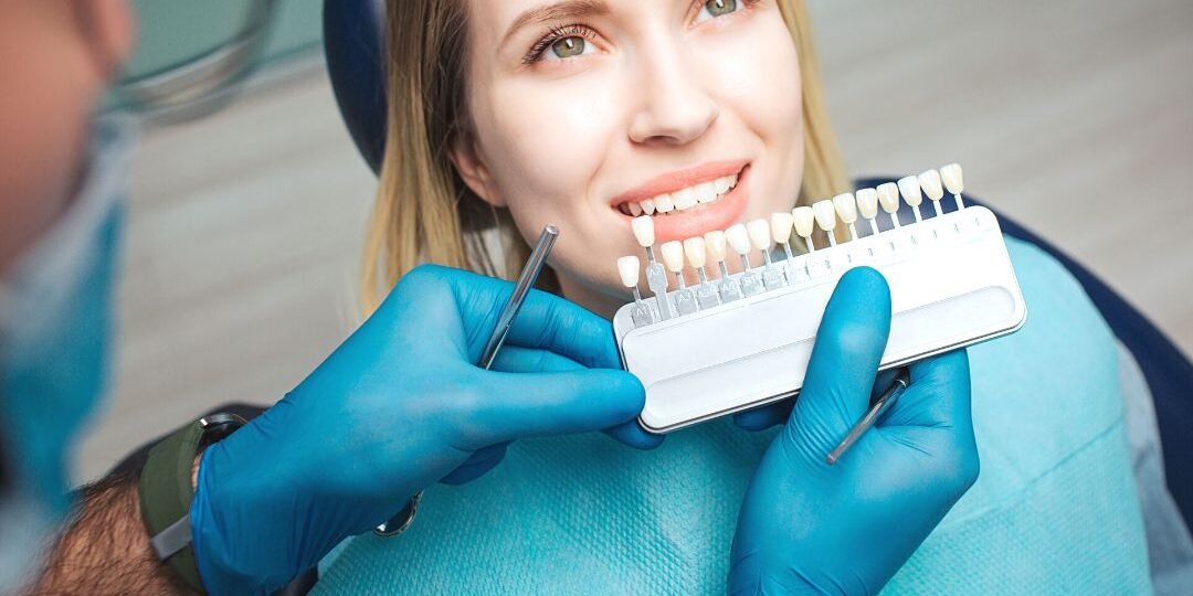 carillas dentales bilbao