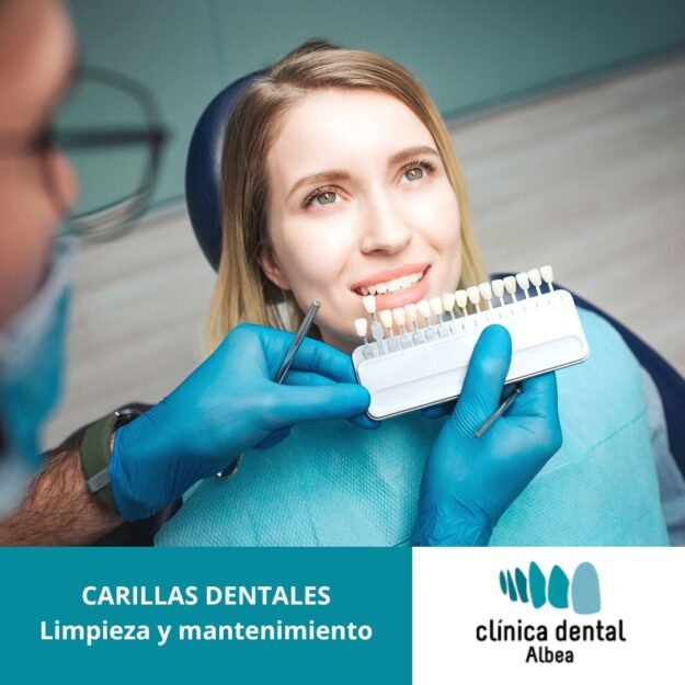 carillas dentales bilbao carillas dentales bilbao