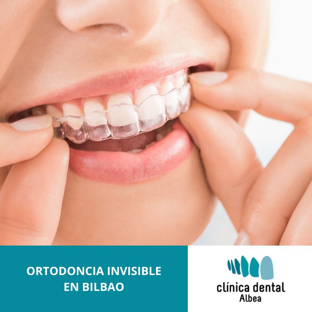 ortodoncia invisible bilbao