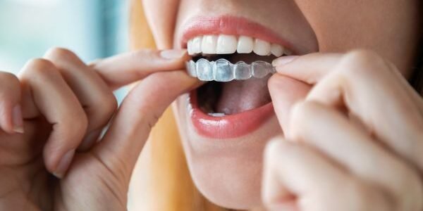 ortodoncia en bilbao