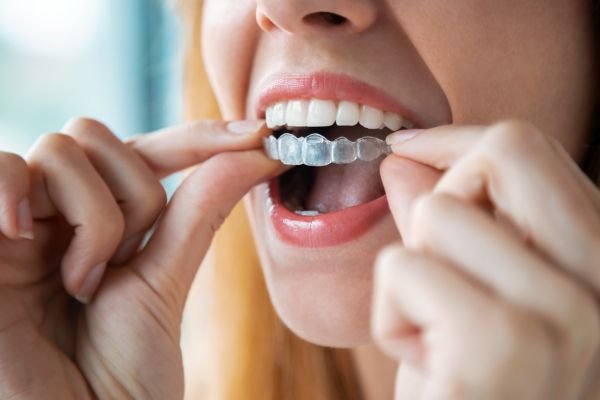 ortodoncia en bilbao