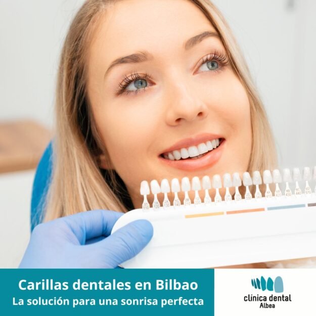 carillas dentales en Bilbao carillas dentales en Bilbao