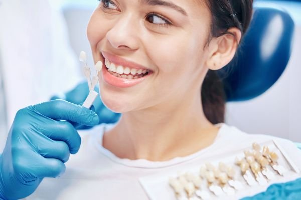 carillas dentales en Bilbao